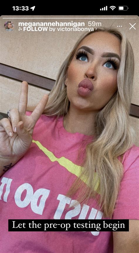 duck lips photo